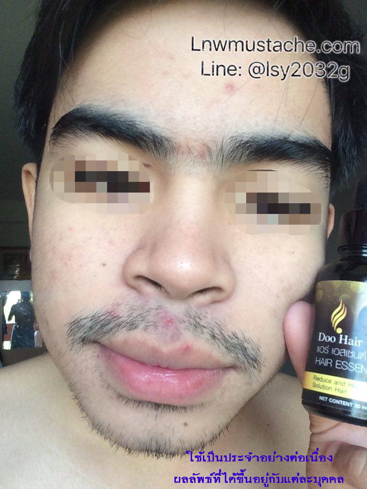 [Doo Hair Essence Serum] ดู แฮร์ เอสเซนต์ เซรั่มปลูกหนวด ปลูกขนคิ้ว ปลูกผม เพิ่มความหนาและดกดำ ขนาด 30 มล. จดแจ้ง อย.