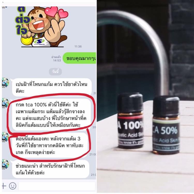 TCA 100%แต้มหลุมสิวลึก กระ ไฝ ฝ้าแต้มกระนูน ใช้จี้ขี้แมงวัน หรือไฝ เม็ดใหญ่ ๆ ช่วยให้สิวแห้งเร็วTrichloroacetic Acid Solution TCA 100% Concentrated Chemical Skin Peel ขนาด 3ml