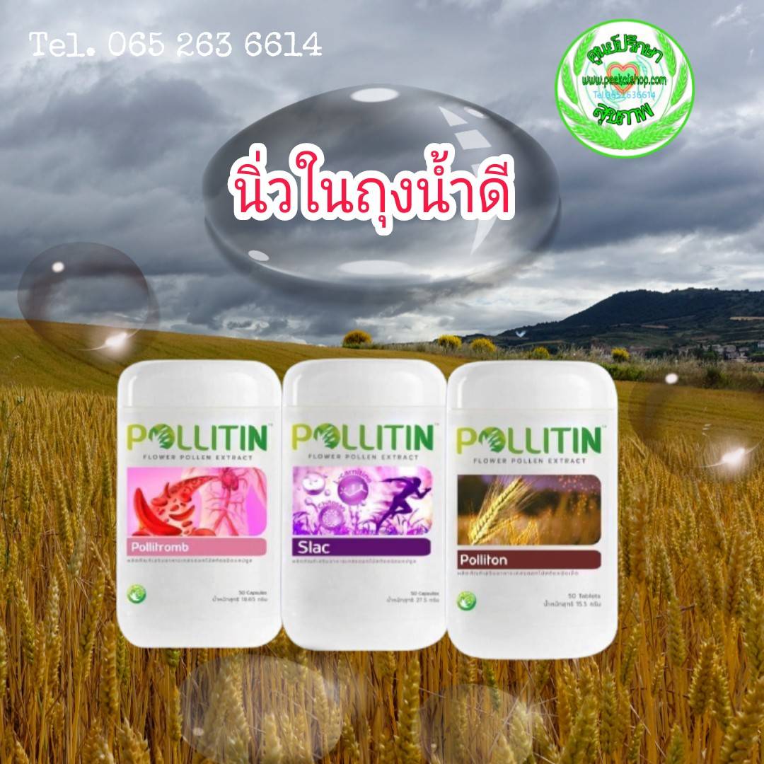 โรคนิ่วในถุงน้ำดี