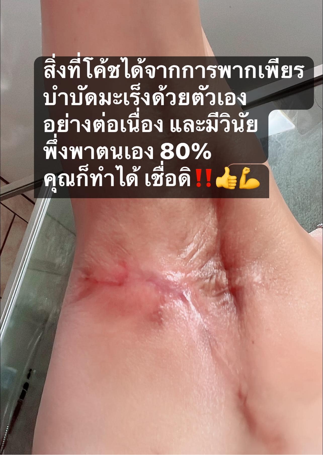 คอร์สเรียนพิเศษจากโค้ชอลิส สรุป 100 เทคนิคพิชิตมะเร็ง