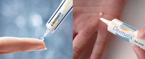 Dermatix Ultra gel 5 g.เดอร์มาติกซ์ อัลตราเจล