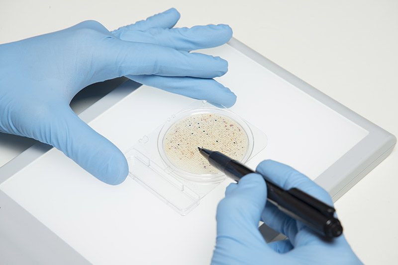 ชุดทดสอบบาซิลลัส ซีเรียสในภาชนะสัมผัสอาหารและมือ/Swab B.cereus (Compact Dry BC)