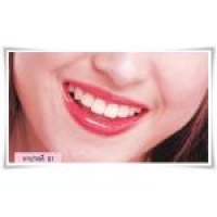 01 ประกายแดง