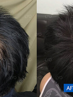 รีวิวผู้ใช้จริง LYO(ไลโอ) เรากล้าท้าให้พิสูจน์