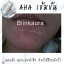 เซรั่มผลัสเซลล์ผิวหน้า AHA เข้มข้น ลอกฝ้า ผลัดเซลล์ผิวหน้า ขนาด 10ml
